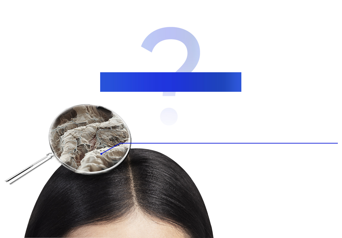 以為洗乾淨 頭屑還是反覆出現