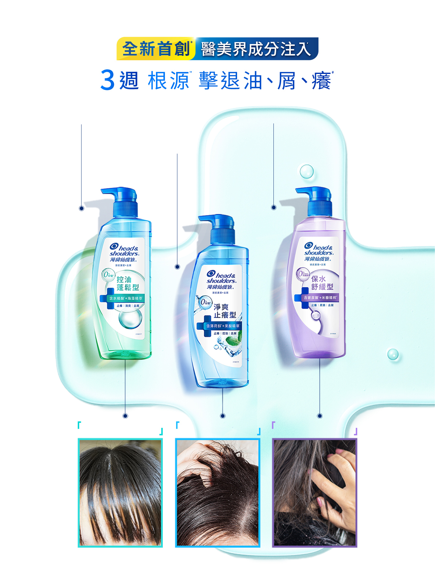 全新首創 醫美界成分注入 3週根源擊退油、屑、癢